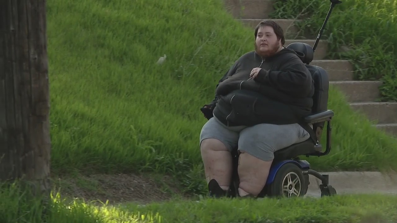 Transgender man shot with pellet gun, taunted with slurs