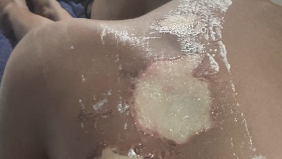 12-year-old who threw acid on girl in Detroit charged