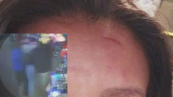 Street vendor brutally attacked in Westlake