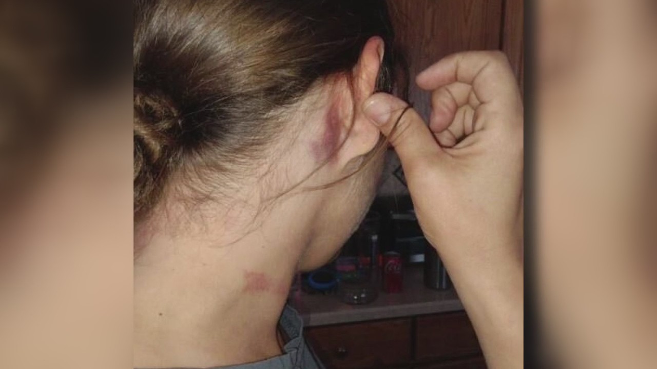 Carjacking victim shares harrowing story of survival