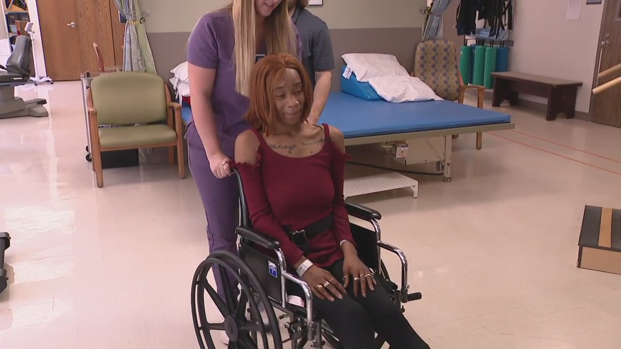 Woman who suffered paralysis from whippets wants to warn others