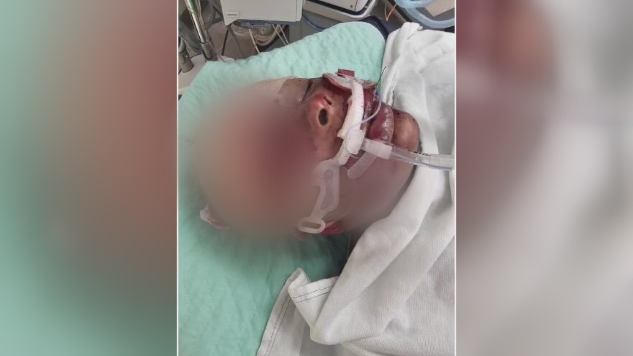 Sisters involved in wild I-94 rollover say it was caused by broken axle