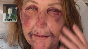 Venice Canals rape suspect sentenced