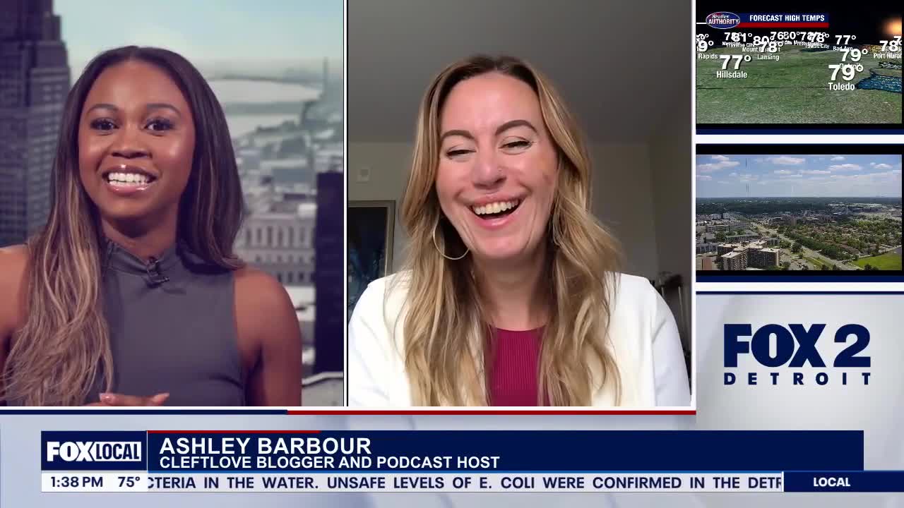 Yspilanti woman born with a cleft lip inspires others at Cleft Con