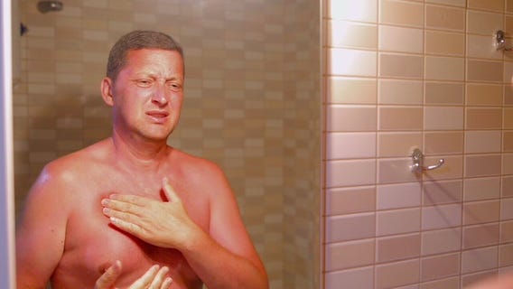 How to prevent, treat sun burns