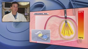 Fibroids are often misdiagnosed - here's what every woman needs to know