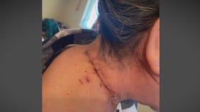 Woman stabbed in neck in East Hollywood