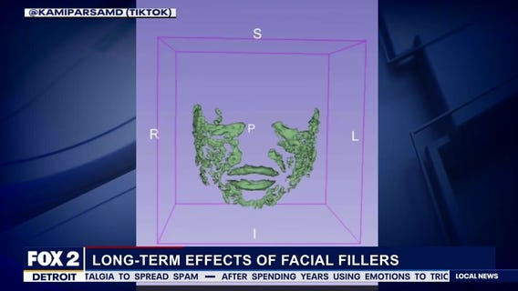 Regenerative aesthetics may be a better option than dermal filler