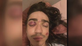 Young man survives angry mob attack in LA