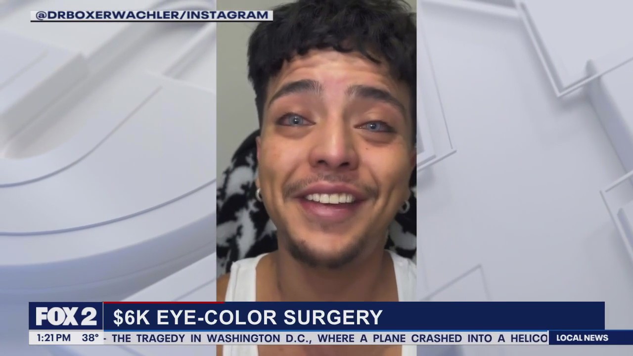 Eye Color Change Surgery