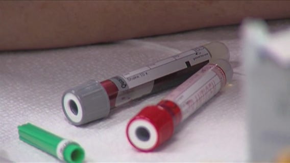 Why STD rates are rising in Metro Detroit