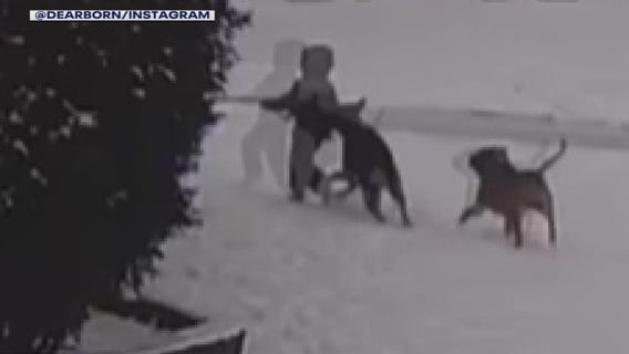 Dearborn Heights 5-year-old attacked by dogs