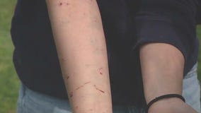 California teen girl attacked by sea lion