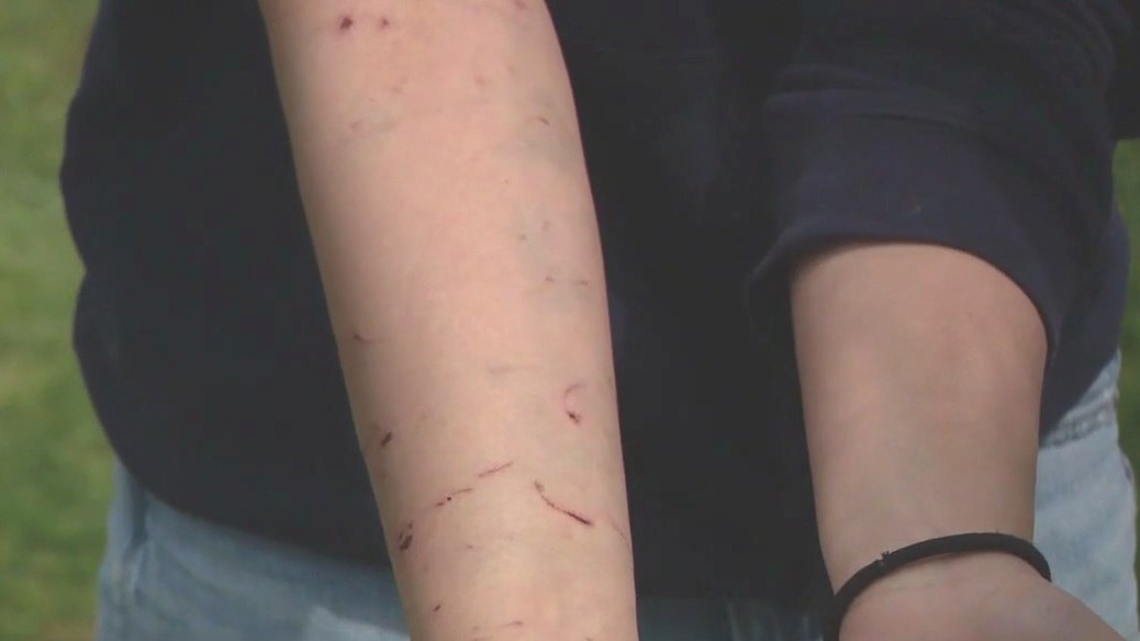 California teen girl attacked by sea lion