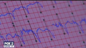 The Doctor Is In: The early signs of heart disease and how wearables can help detect heart irregularities