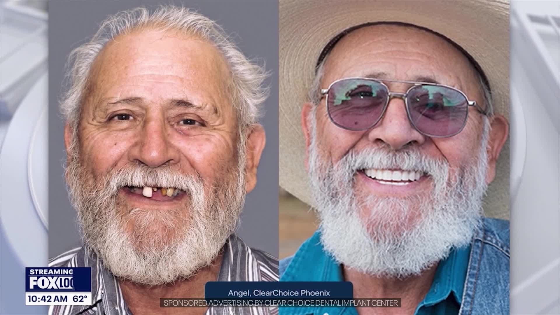 Reclaim your smile & confidence with ClearChoice Dental Implant Center