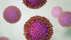 Experts track Measles outbreak in Michigan