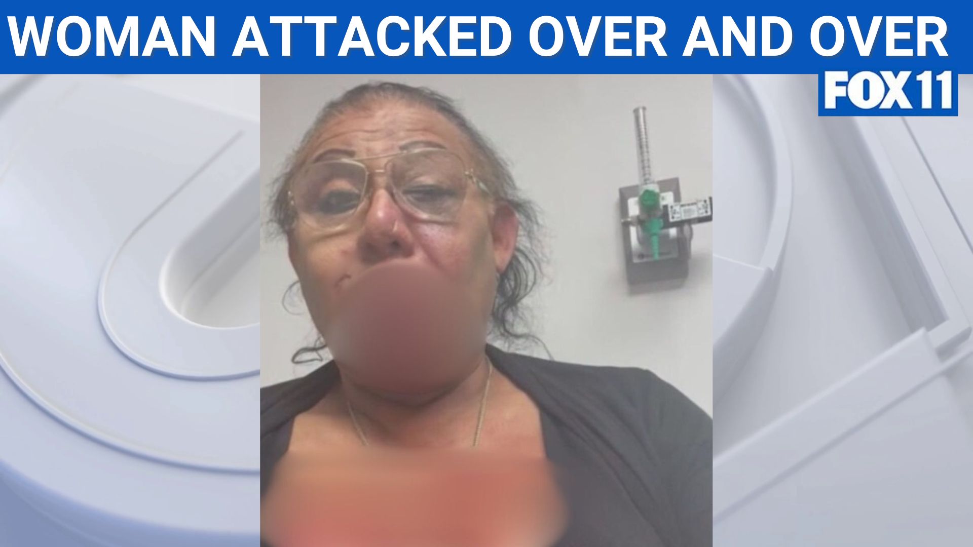 Transgender woman violently attacked for 6th time