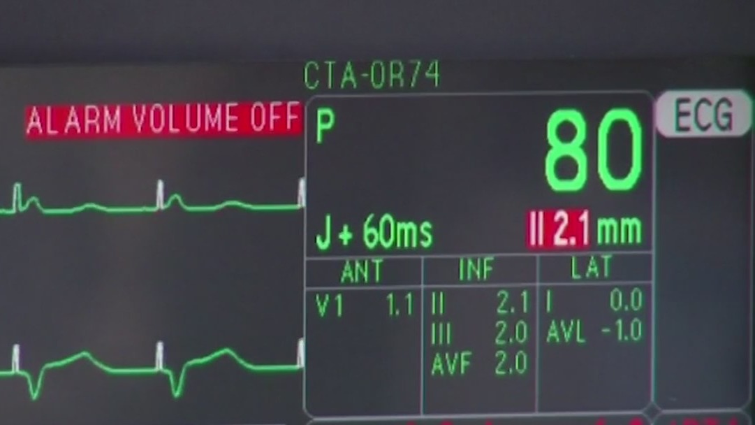 Healthworks: Protecting women's hearts