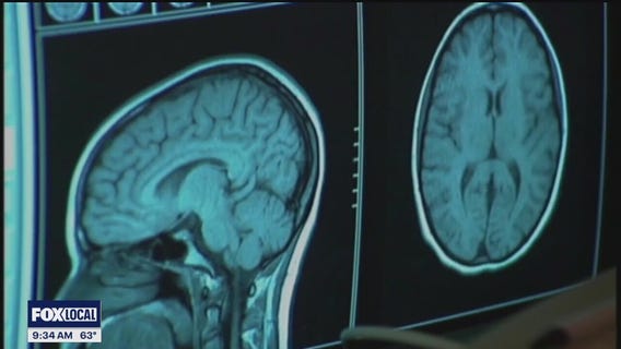 The Doctor Is In: Recognize stroke symptoms and minimize your risk