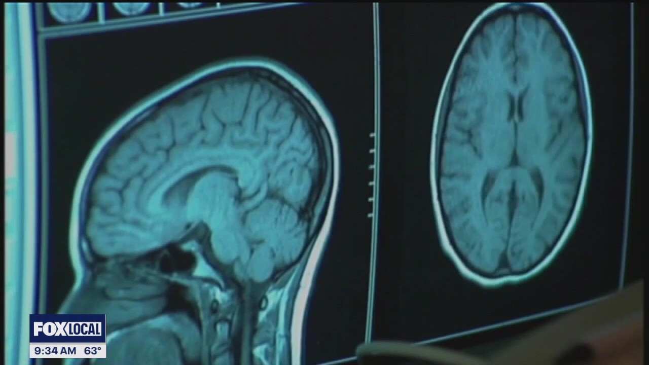 The Doctor Is In: Recognize stroke symptoms and minimize your risk