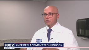New knee replacement technology technique expected to be way of the future