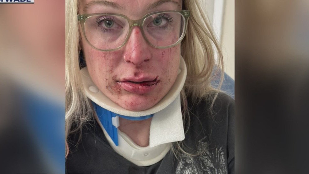 Alleged assault and hate crime outside Detroit MGM Casino