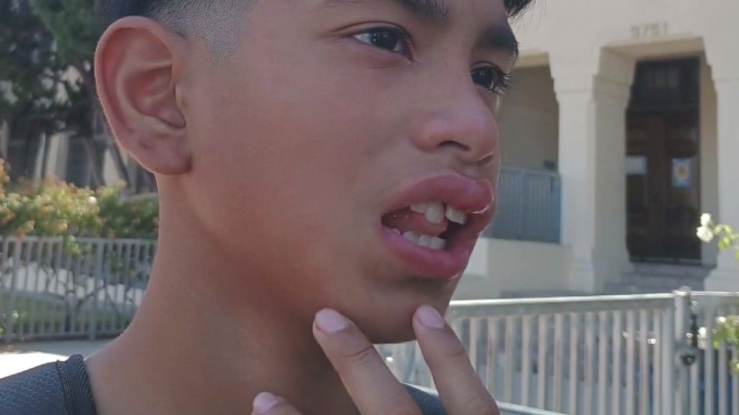 Child says he got attacked by brass knuckles