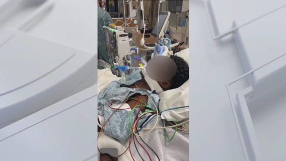 Family sues LAPD claiming officers intentionally hit teen on motorbike