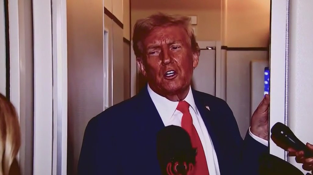 Trump Administration to link autism to Tylenol use