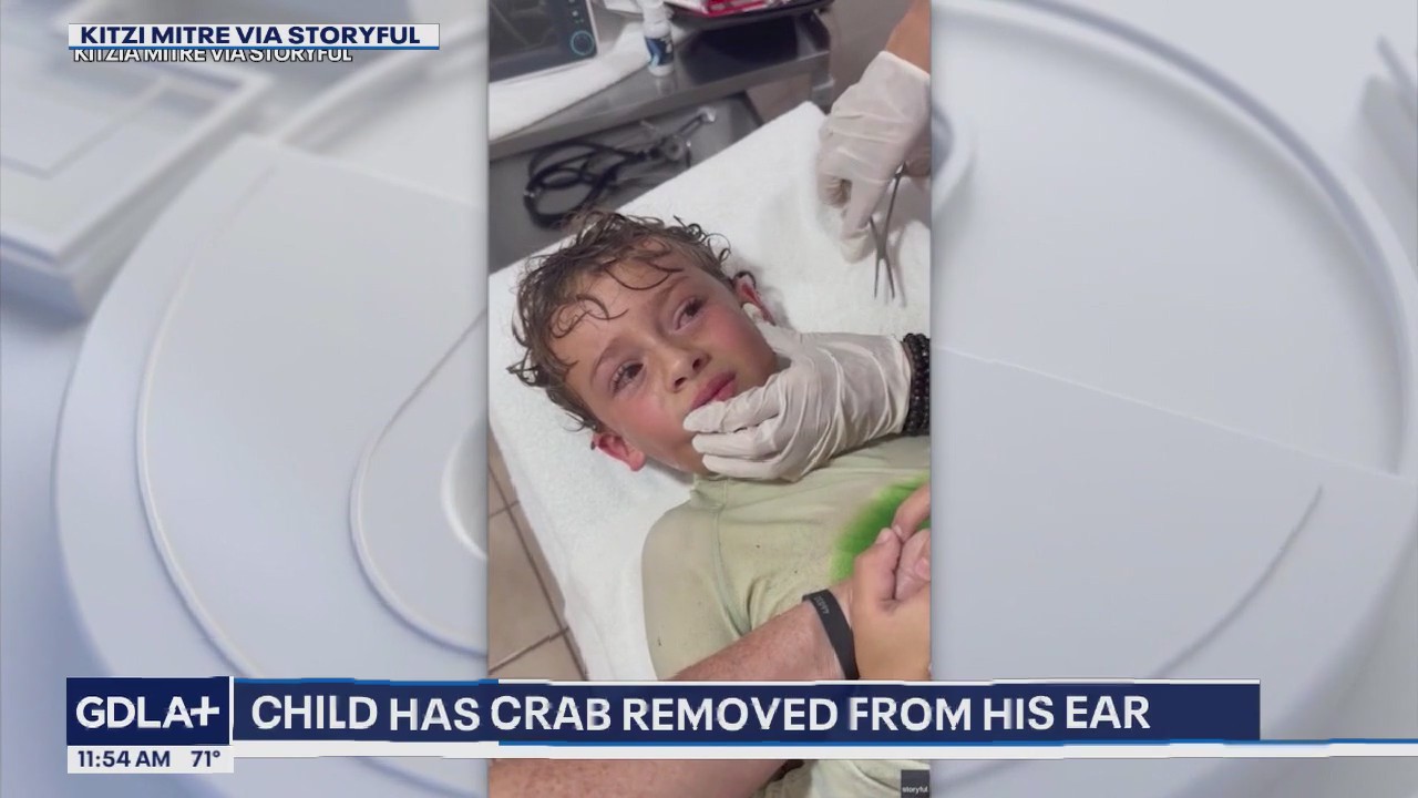 Live crab removed from boy's ear