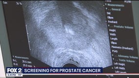 Prostrate cancer screening starts with a blood test