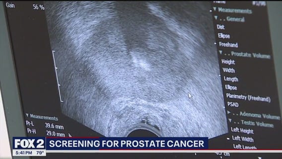 Prostrate cancer screening starts with a blood test