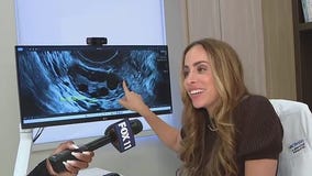 Bringing awareness to PCOS