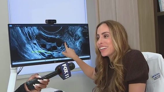 Bringing awareness to PCOS