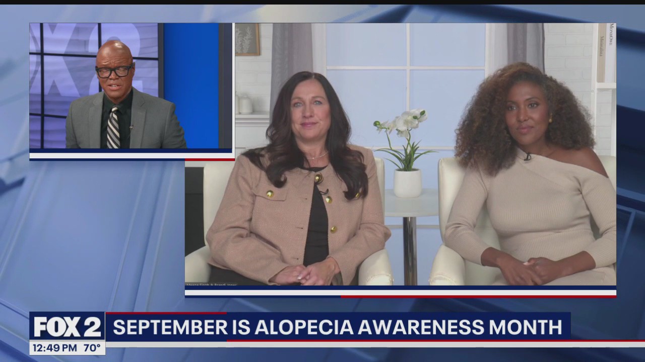 September is Alopecia Awareness Month