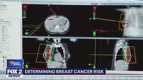 Breast cancer screening and early detection is key