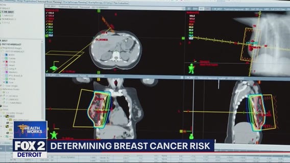 Breast cancer screening and early detection is key