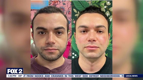 Targeting Dark Circles and Skin Concerns This Fall