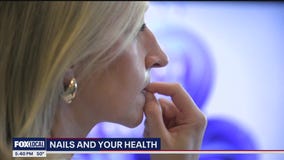 Nail changes tell a story about your health