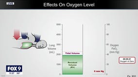 Dr. Tobin: No oxygen left in George Floyd's body