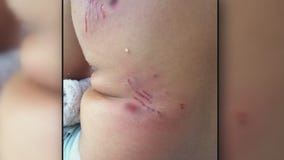 Dog attack caught on camera