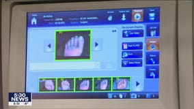 New device allows for faster treatment of frostbite patients