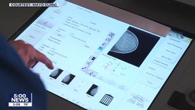 After breast cancer treatment, Sen. Klobuchar urges women not to put off mammograms