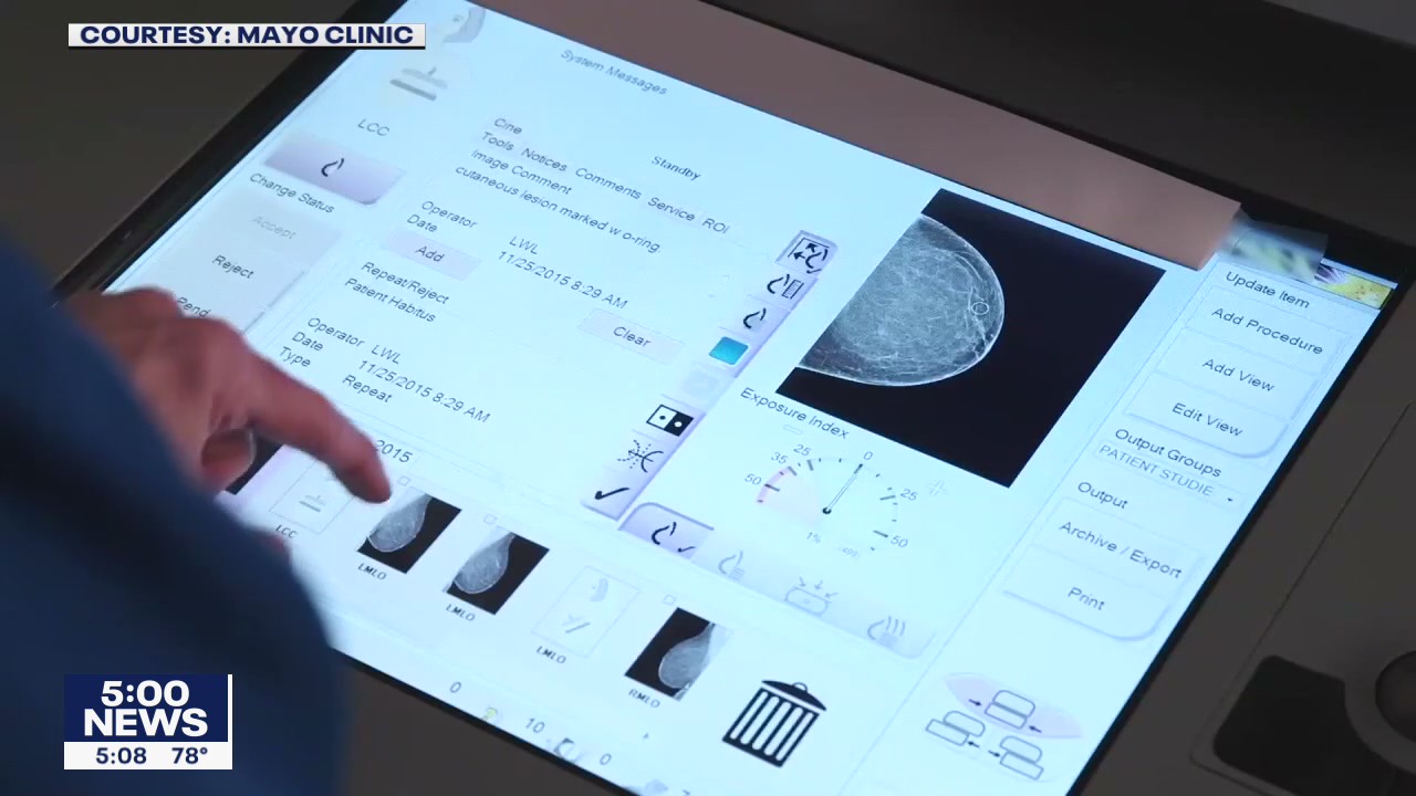 After breast cancer treatment, Sen. Klobuchar urges women not to put off mammograms