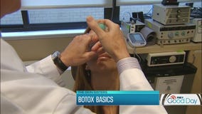 Botox basics: The Skin Sisters answer your questions on how Botox works