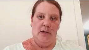 Mankato chase stabbing victim speaks