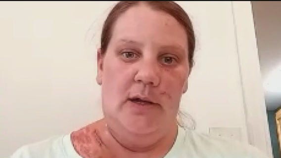 Mankato chase stabbing victim speaks