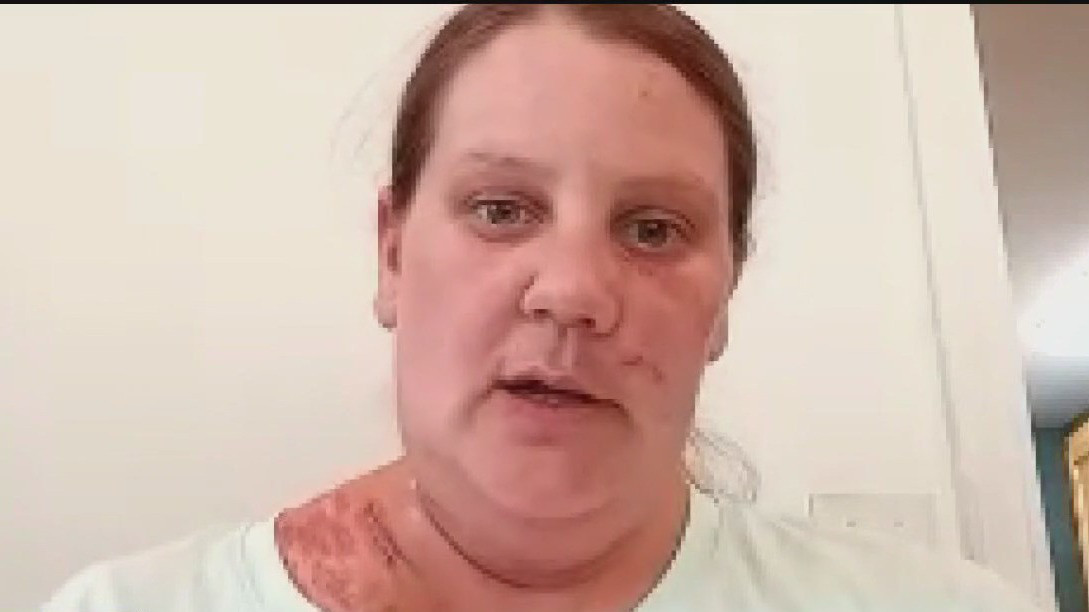 Mankato chase stabbing victim speaks