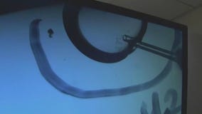 Fertility coverage bill slows down at MN Capitol